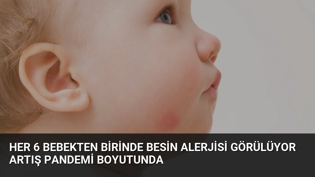 Her 6 Bebekten Birinde Besin Alerjisi Görülüyor Artış Pandemi Boyutunda